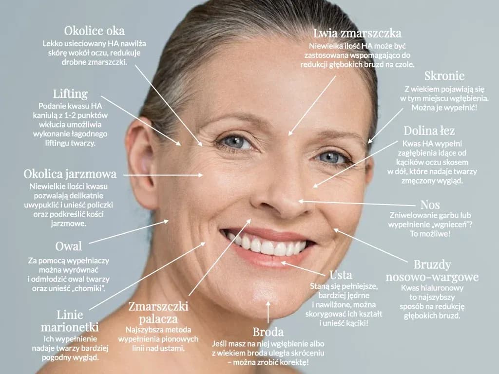 Gdzie można kupić kwas hialuronowy - najlepsze miejsca i porady