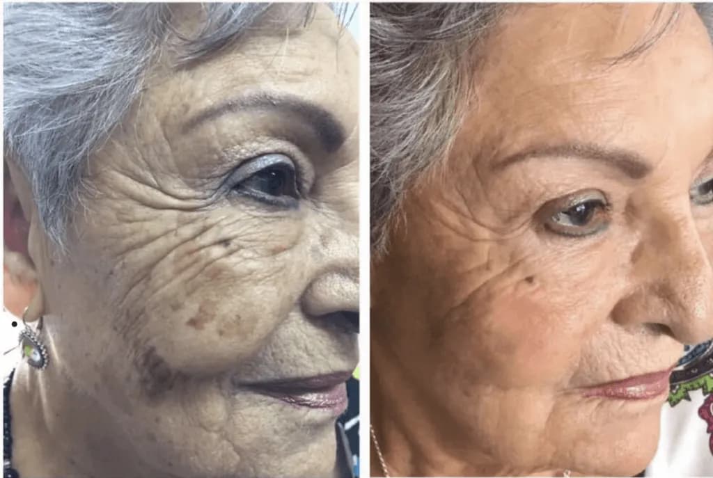 Gdzie kupić deep phyto peeling? Sprawdź najlepsze opcje i miejsca