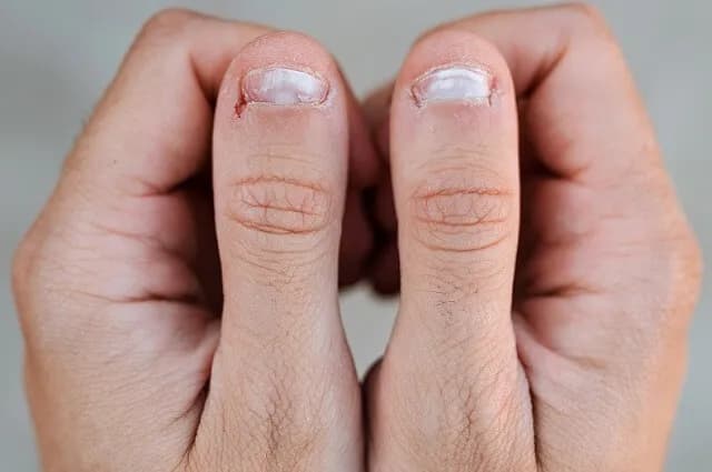 Jak odbudować macierz paznokcia i przywrócić jej zdrowie?